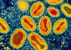 Destruction of smallpox virus delayed | Recurso educativo 71726