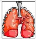 Enfermedades alérgicas de los pulmones | Recurso educativo 76238