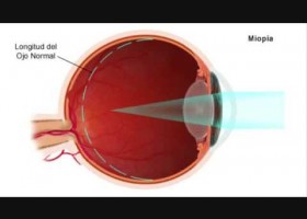 El ojo humano | Recurso educativo 745546